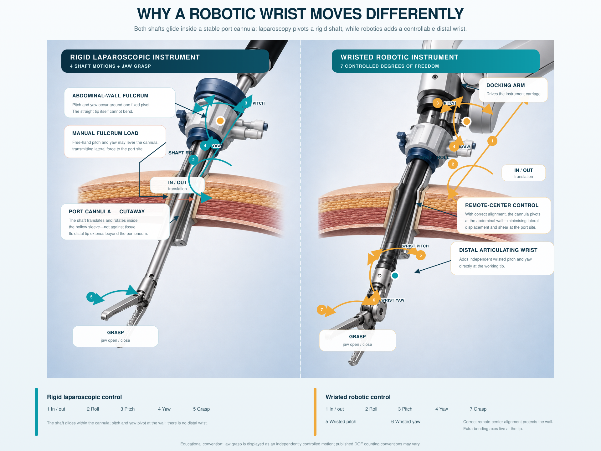 A detailed comparison of rigid laparoscopic and wristed robotic instruments, showing their ports, abdominal-wall pivots, movement axes, docking arm and distal articulation